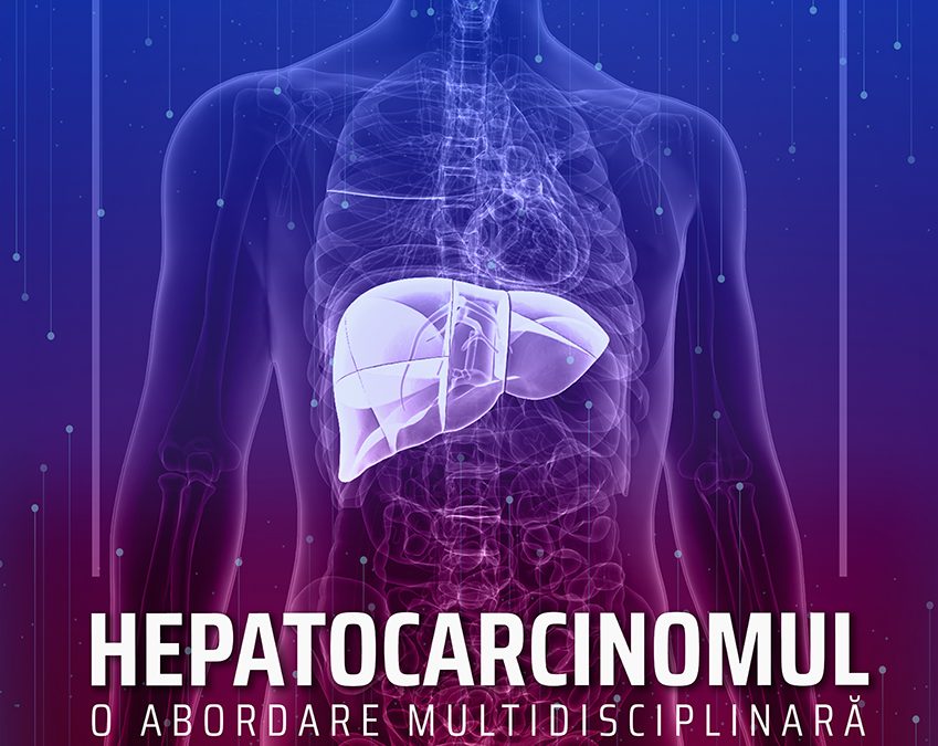 Hepatocarcinomul – o abordare multidisciplinară